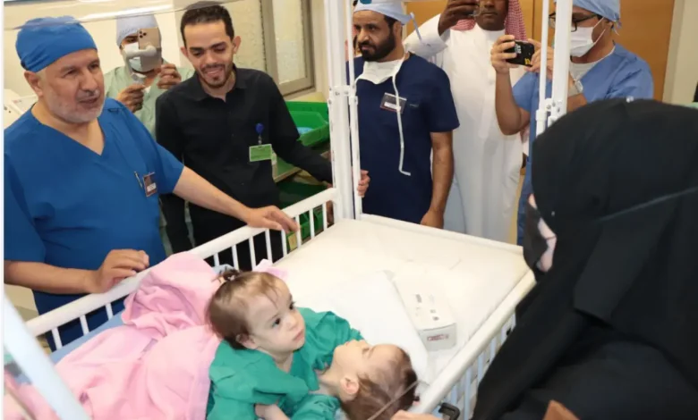 فريق طبي سعودي يبدأ فصل التوأم السوري سيلين وإيلين في عملية معقدة بالرياض